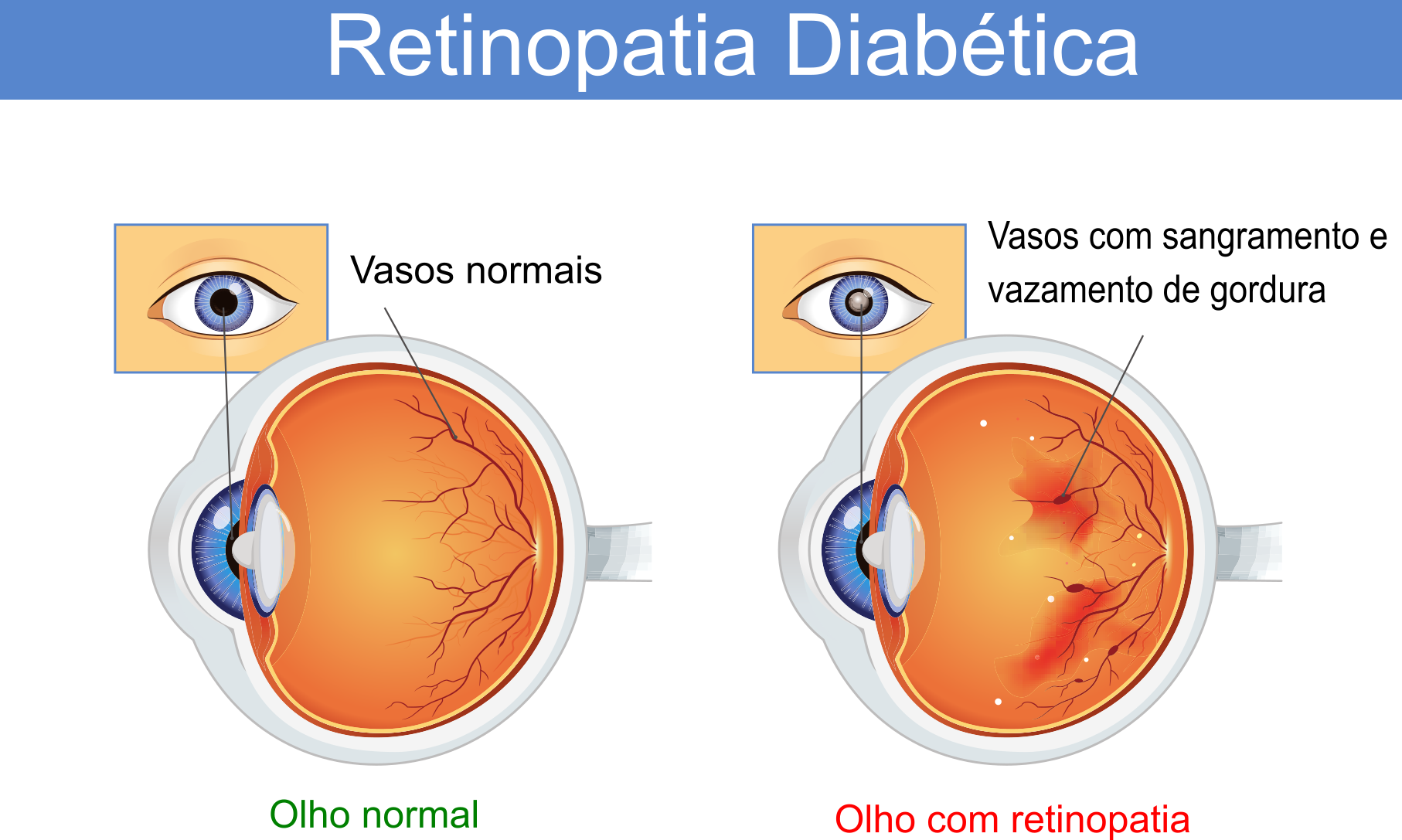 Cirurgias Clínica Cid Laser, Clínica de Olhos Cid Laser