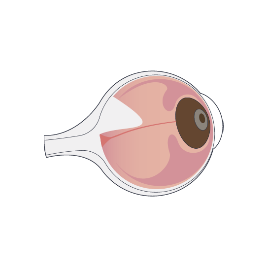 Clínica Preti Eye - Prof. Dr. Rony Preti - Especialista em Descolamento de Retina